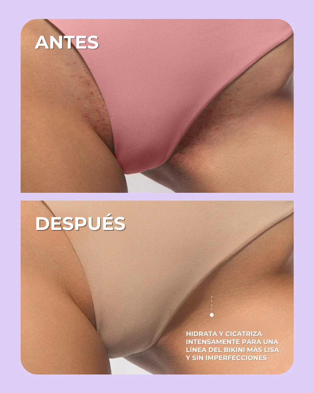 Original Aceite Premium Truly - Una Piel radiante y sin imperfecciones sin esfuerzo + Regalo Exclusivo!