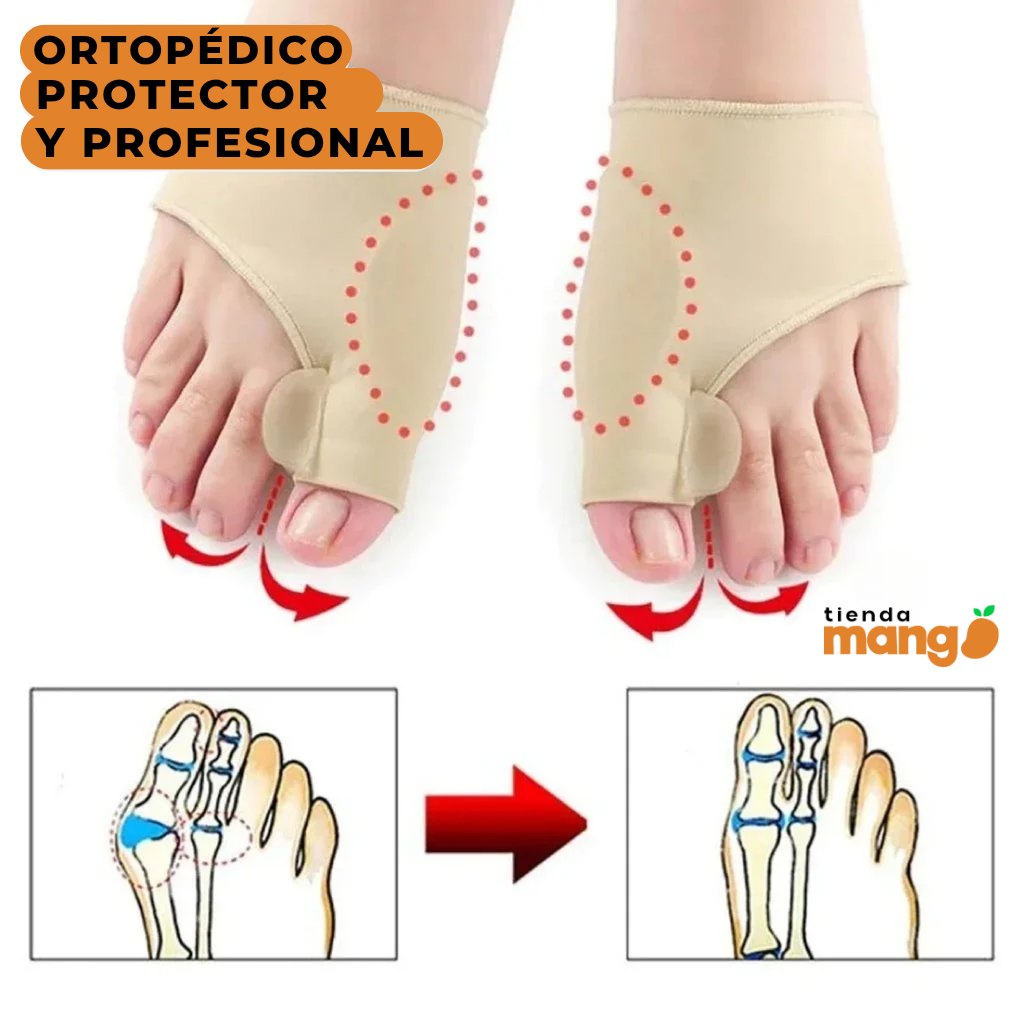 CorrectionMax - Corrector Ortipedico de Juanetes Premium (Ultimas Unidades)